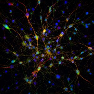 ExCyte extracellular vesicle fluorescence microscopy
